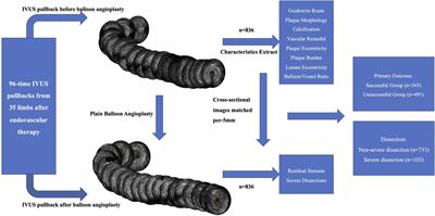 Impact of plaque and luminal morphology in balloon angioplasty of the femoropopliteal artery: an intravascular ultrasound analysis
